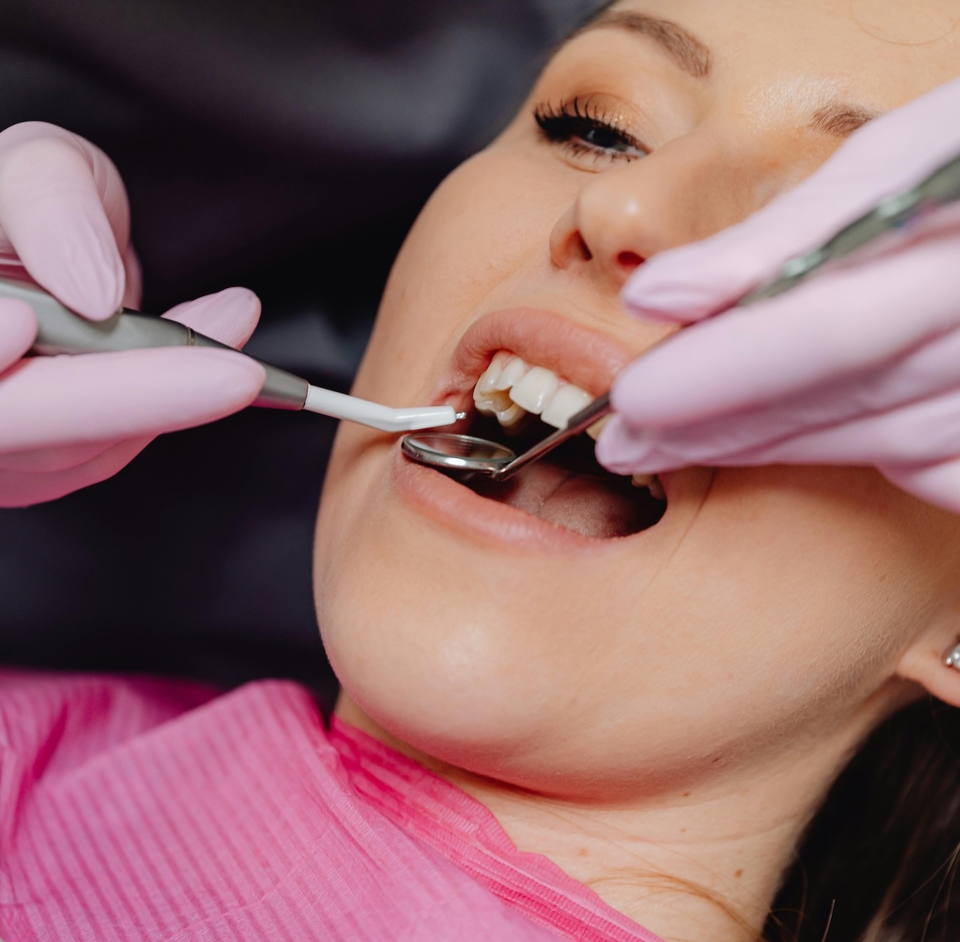 hambakivi eemaldamine